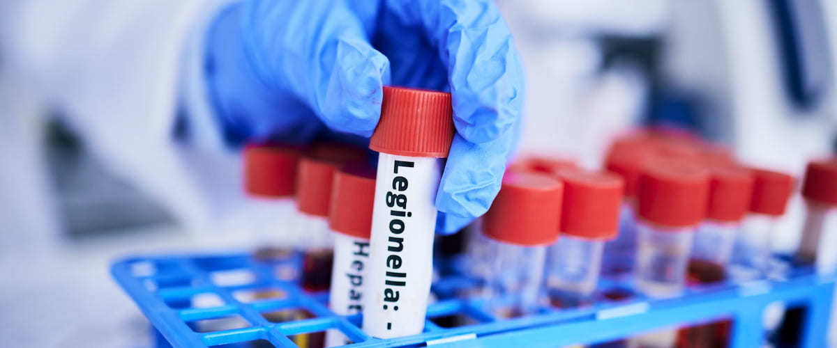 Prevenzione e valutazione del Rischio Legionella nelle aziende