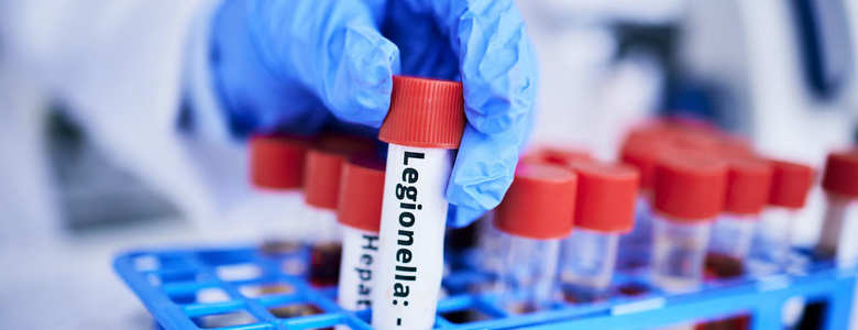 Prevenzione e valutazione del Rischio Legionella nelle aziende
